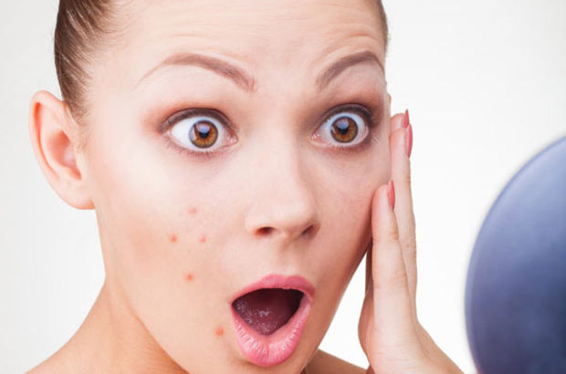 Bir Acne Vulgarisli’den Notlar.. (Misafir Yazar)